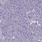 OAT Antibody in Immunohistochemistry (IHC)