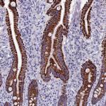 OAT Antibody in Immunohistochemistry (IHC)