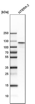 NOP2 Antibody in Western Blot (WB)