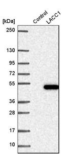 LACC1 Antibody in Western Blot (WB)