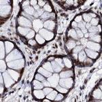 CSTF3 Antibody in Immunohistochemistry (IHC)