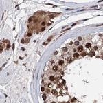 CSTF3 Antibody in Immunohistochemistry (IHC)