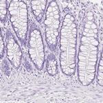 TGM1 Antibody in Immunohistochemistry (IHC)