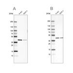 Sorbitol Dehydrogenase Antibody in Western Blot (WB)