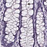 SPEF2 Antibody in Immunohistochemistry (IHC)