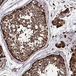 CKAP5 Antibody in Immunohistochemistry (IHC)