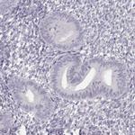 NUTM1 Antibody in Immunohistochemistry (IHC)