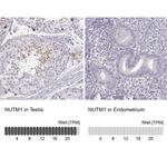 NUTM1 Antibody