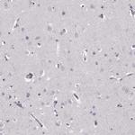 Cystatin F Antibody in Immunohistochemistry (IHC)