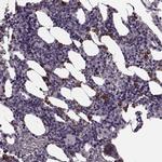 Cystatin F Antibody in Immunohistochemistry (IHC)