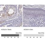 ACSL6 Antibody in Immunohistochemistry (IHC)