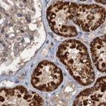 CEP68 Antibody in Immunohistochemistry (IHC)