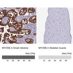 MYO5B Antibody in Immunohistochemistry (IHC)