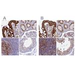 MYO5B Antibody in Immunohistochemistry (IHC)