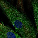 SCUBE3 Antibody in Immunocytochemistry (ICC/IF)