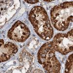 CEP68 Antibody in Immunohistochemistry (IHC)