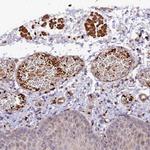 WDFY4 Antibody in Immunohistochemistry (IHC)