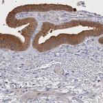 NEK8 Antibody in Immunohistochemistry (IHC)