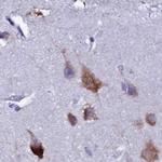 EEF1G Antibody in Immunohistochemistry (IHC)