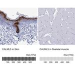 CALML5 Antibody