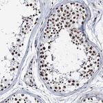 ZNF609 Antibody in Immunohistochemistry (IHC)