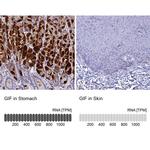 GIF Antibody in Immunohistochemistry (IHC)