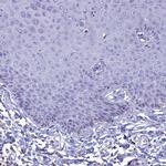 GIF Antibody in Immunohistochemistry (IHC)