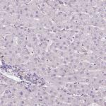 DLAT Antibody in Immunohistochemistry (IHC)