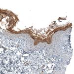 XP32 Antibody in Immunohistochemistry (IHC)