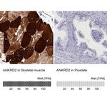 ANKRD2 Antibody