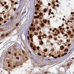 ZC3H18 Antibody in Immunohistochemistry (IHC)