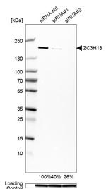 ZC3H18 Antibody in Western Blot (WB)