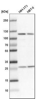 alanyl-tRNA Synthetase Antibody in Western Blot (WB)