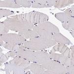 eIF6 Antibody in Immunohistochemistry (IHC)