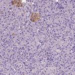 GNAO1 Antibody in Immunohistochemistry (IHC)