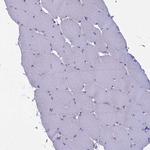 MYO5B Antibody in Immunohistochemistry (IHC)