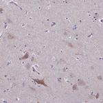 MYO5B Antibody in Immunohistochemistry (IHC)