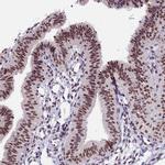 ZC3H4 Antibody in Immunohistochemistry (IHC)