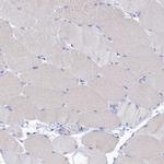 OCIAD2 Antibody in Immunohistochemistry (IHC)