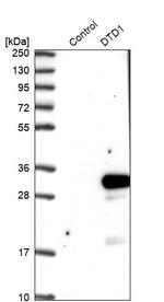 DTD1 Antibody in Western Blot (WB)