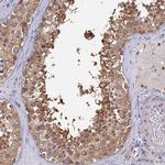 IPO5 Antibody in Immunohistochemistry (IHC)