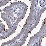 POMGNT2 Antibody in Immunohistochemistry (IHC)