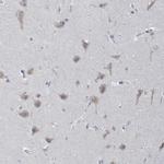 POMGNT2 Antibody in Immunohistochemistry (IHC)