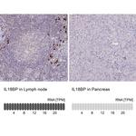 IL18BP Antibody