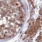 MKKS Antibody in Immunohistochemistry (IHC)