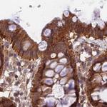 MKKS Antibody in Immunohistochemistry (IHC)