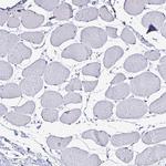 PLA2G4E Antibody in Immunohistochemistry (IHC)