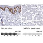 PLA2G4E Antibody