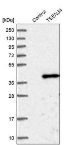 TSEN34 Antibody in Western Blot (WB)