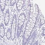 ZG16B Antibody in Immunohistochemistry (IHC)